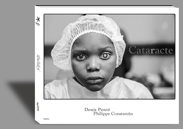 Cataracte, photographie denis ponté